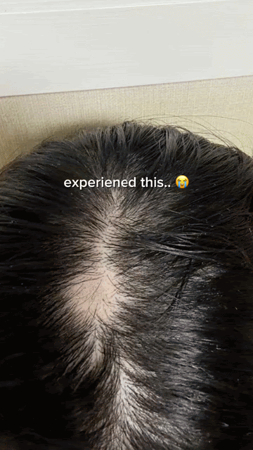 로즈마리 루트 인헨서